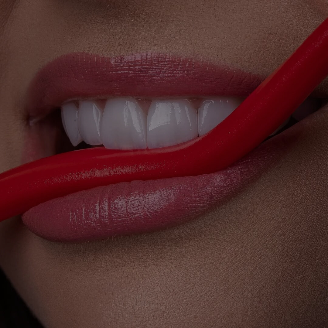 Mais um sorriso totalmente transformado com as Lentes de Contato Dental Padrão Viotto!! ...........#LentedeContatoDental #SorrisoViotto....Realizando sonhos em Goiânia! .. (62) 9 9518-1430... R. 144, 101 (5)